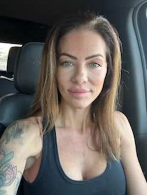 Happy Woman With Little To No Swelling Month After Facelift Surgery